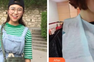 昆明愛(ài)齊口腔門診部朱婭整形價(jià)格表附牙齒隱形矯正案例展示