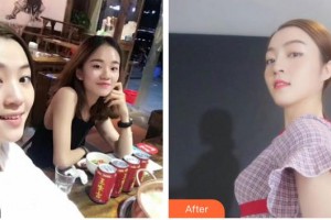 昭通瑪麗婦產(chǎn)醫(yī)院整形美容科韓受亨整形價格表附隆鼻案例展示