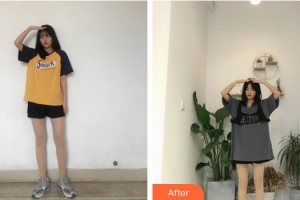 武漢美侖醫(yī)療美容門診部陳遠(yuǎn)海整形價(jià)格表附大腿吸脂案例展示