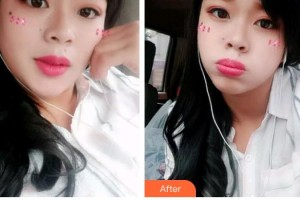 石家莊星源美天醫(yī)療美容醫(yī)院甄翠欣整形價格表附冷光美白案例展示