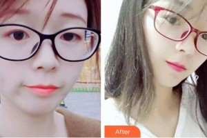 石家莊貴美人醫(yī)療美容醫(yī)院鄒慧嫻整形價(jià)格表附微針?biāo)獍咐故?>
</a>
<h3 class=