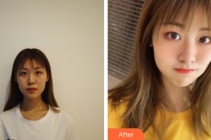 武漢唯韓醫(yī)療美容門診部方濤整形價(jià)格表附眼部手術(shù)案例展示