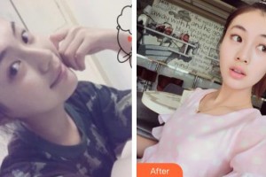 石家莊俏之翼醫(yī)療美容門診部姜凱整形價(jià)格表附光子嫩膚案例展示