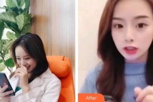 石家莊雅芳亞醫(yī)療美容醫(yī)院程雪艷整形價格表附超聲波潔牙案例展示