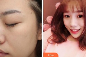 唐山星范醫(yī)療美容門診部杜太超整形價(jià)格表附眼部綜合案例展示