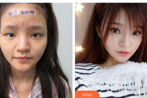 唐山美尚醫(yī)療美容診所余百林整形價(jià)格表附隆鼻案例展示