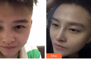 唐山美泉醫(yī)療美容診所王首燕整形價(jià)格表附鼻部綜合案例展示