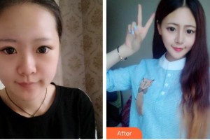 唐山鄧柏林醫(yī)療美容診所鄧柏林整形價(jià)格表附鼻部綜合案例展示