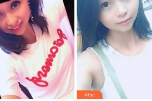 唐山市人民醫(yī)院燒傷整形科張玲整形價(jià)格表附眼部綜合案例展示