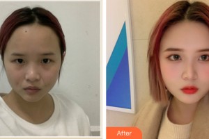 武漢微幕醫(yī)療美容門診部寧夏整形價(jià)格表附皮膚美容案例展示