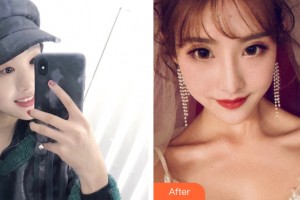 ?？诩t妝尚醫(yī)療美容門診部關(guān)海濤整形價(jià)格表附眼部手術(shù)案例展示