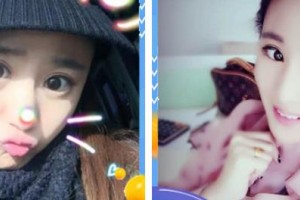 秦皇島巧致美容醫(yī)院胡巧致整形價(jià)格表附切開(kāi)雙眼皮案例展示