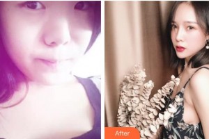 唐山光明醫(yī)院樊鄭軍整形價格表附眼部綜合案例展示