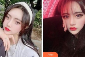 唐山冀東眼科醫(yī)院海整形價格表附開內眼角案例展示