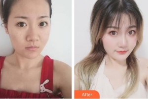 唐山冀東眼科醫(yī)院楊露整形價格表附眼部綜合案例展示