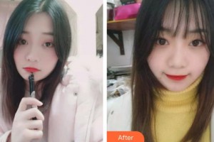 唐山牙博士口腔醫(yī)院韓亞春整形價格表附牙齒隱形矯正案例展示