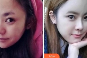 邯鄲現(xiàn)代麗人醫(yī)院整形美容中心姜昌軍整形價格表附鼻部綜合案例展示