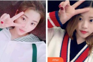 保定牙博士口腔醫(yī)院王鵬整形價格表附牙貼面案例展示