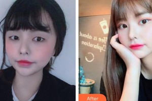 保定新視眼科醫(yī)院武蘊(yùn)琴整形價格表附眼部綜合案例展示