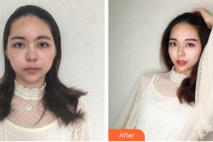 中山愛思特美容醫(yī)院　徐紅梅整形價(jià)格表附紋眉案例展示