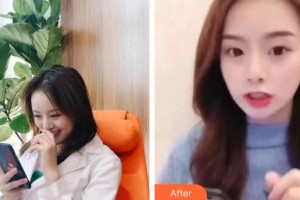 保定東陽口腔醫(yī)院溫興整形價(jià)格表附牙貼面案例展示