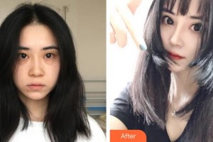 張家口維多利亞醫(yī)療美容醫(yī)院孫凱整形價(jià)格表附鼻部綜合案例展示