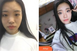 滄州靜港醫(yī)療美容診所韓興斌整形價格表附鼻部綜合案例展示