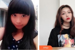 太原華美整形美容醫(yī)院邢藝濱整形價(jià)格表附熱拉提案例展示