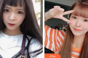 太原晉容整形美容門診部李梅整形價(jià)格表附E光嫩膚案例展示