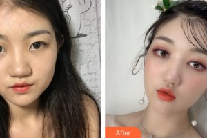 桂林華美醫(yī)療美容門診部游海鋒整形價格表附雙眼皮手術(shù)案例展示