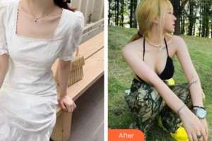 柳州華美整形美容醫(yī)院宋建星整形價格表附隆胸手術(shù)案例展示