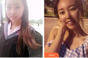 太原星范醫(yī)療美容門診部張清華整形價(jià)格表附牙齒陶瓷矯正案例展示