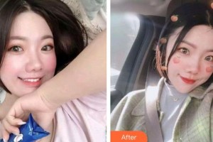 太原愛爾眼科醫(yī)院席海杰整形價格表附激光去黑眼圈案例展示