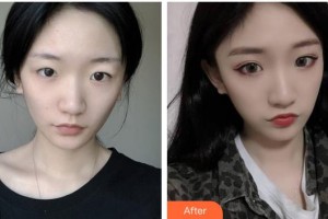 大同清木整形醫(yī)院姜際珠整形價(jià)格表附鼻部綜合案例展示