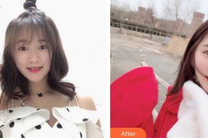 大同市第二人民醫(yī)院整形燒傷外科駱強(qiáng)整形價(jià)格表附鼻部綜合案例展示