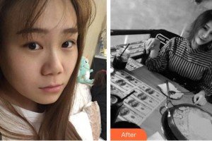 大同魅力舍賓美容診所梁冬明整形價(jià)格表附假體隆鼻案例展示