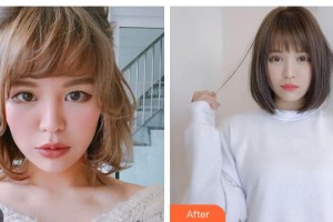 晉城修形美林整形醫(yī)院郭明雷整形價(jià)格表附切開(kāi)雙眼皮案例展示