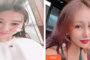 晉中鷹華眼科醫(yī)院王艷華整形價格表附眼部綜合案例展示