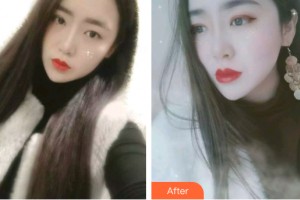 三亞微笑口腔門診部張福湖整形價(jià)格表附牙齒矯正案例展示