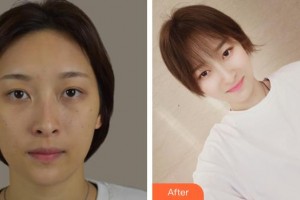 運(yùn)城市皮膚病醫(yī)院醫(yī)學(xué)美容科郭紅磊整形價(jià)格表附清潔祛痘案例展示