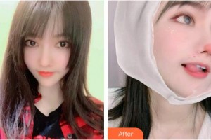 運(yùn)城市眼科醫(yī)院衛(wèi)晶仙整形價(jià)格表附切開雙眼皮案例展示