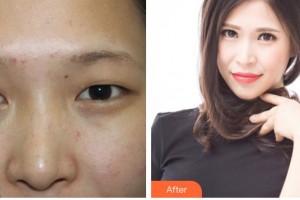 運城市眼科醫(yī)院李文俊整形價格表附眼部綜合案例展示