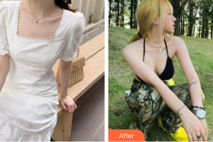 南昌佳美美容醫(yī)院張常整形價格表附隆胸手術案例展示