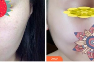 呼和浩特吳老貴醫(yī)學(xué)美容診所吳老貴整形價格表附微針?biāo)獍咐故?>
</a>
<h3 class=