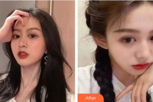 包頭麗人婦產(chǎn)醫(yī)院醫(yī)學美容科梁月月整形價格表附無針水光案例展示