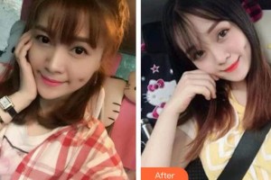 赤峰市醫(yī)院燒傷整形美容科孟凡軍整形價格表附眼部綜合案例展示