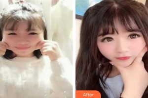 赤峰康華皮膚病醫(yī)院陳海昆整形價格表附埋線雙眼皮案例展示