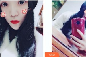 吉林銘醫(yī)整形美容醫(yī)院邵仁玲整形價格表附微針水光案例展示