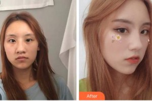 長(zhǎng)春韓一美容醫(yī)院金載旭整形價(jià)格表附鼻部綜合案例展示