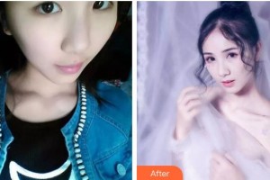 長(zhǎng)春愛(ài)麗醫(yī)療美容門診部華淑麗整形價(jià)格表附眼部綜合案例展示